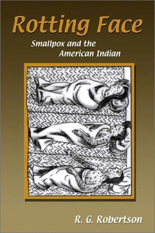 Rotting face : smallpox and the American Indian / R.G. Robertson.